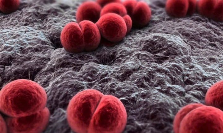 Nam quân nhân tử vong do nhiễm não mô cầu