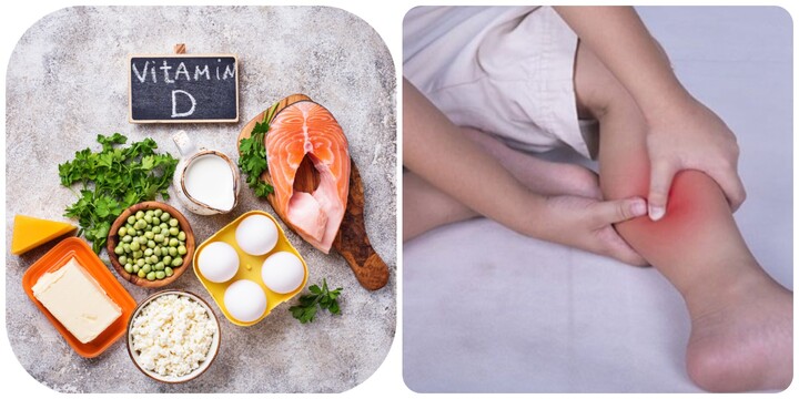 Thiếu vitamin D gây bệnh gì?