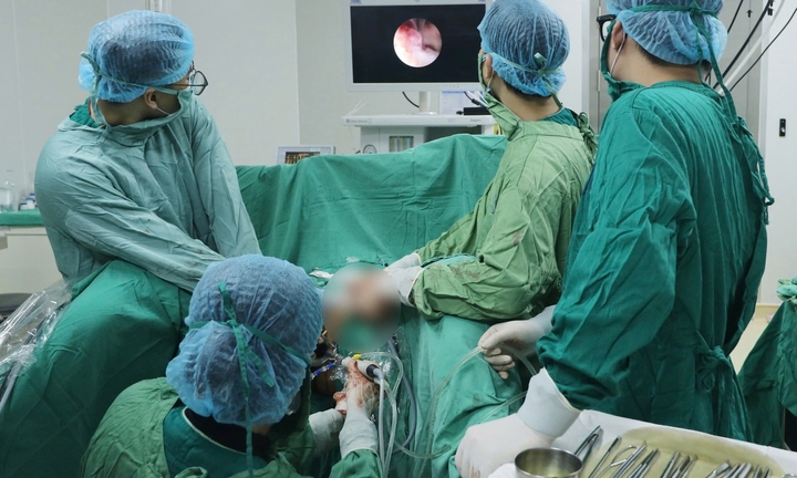 Bụng to bất thường, đi khám phát hiện khối u nặng 1,7kg