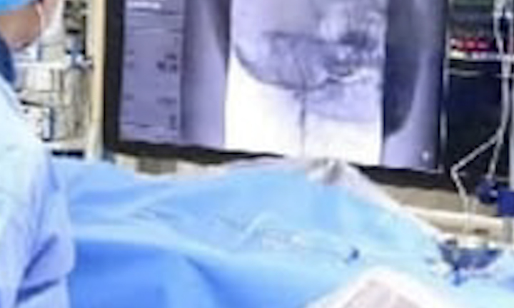 Cứu sống bé trai 12 tuổi đột quỵ khi đang học bài 