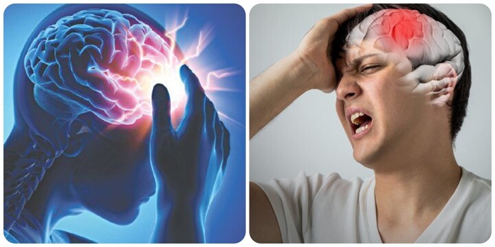  6 dấu hiệu cảnh báo đột quỵ sớm