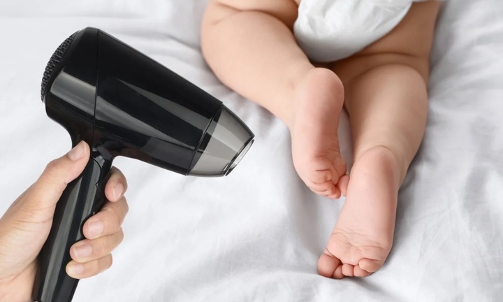 Em bé bỏng nặng, phải cắt 3 ngón chân do mẹ bật máy sấy tóc rồi ngủ quên