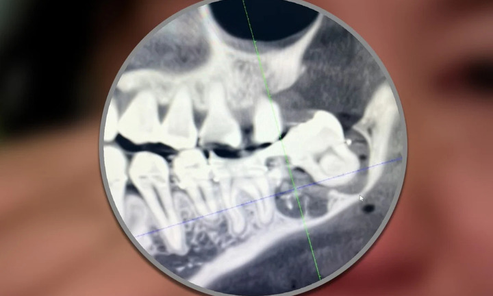 Người phụ nữ nhảy lầu tại bệnh viện sau khi bị nhổ nhầm răng khôn