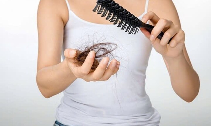 Rụng tóc nhiều bất thường có phải dấu hiệu ung thư?