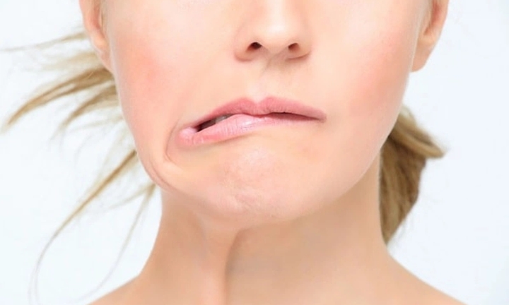 Bị lệch một bên mặt sau khi ngủ dậy