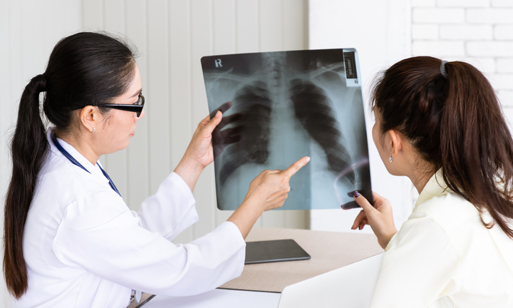 28 tuổi bị ung thư phổi và lời cảnh báo từ bác sĩ khiến nhiều người giật mình