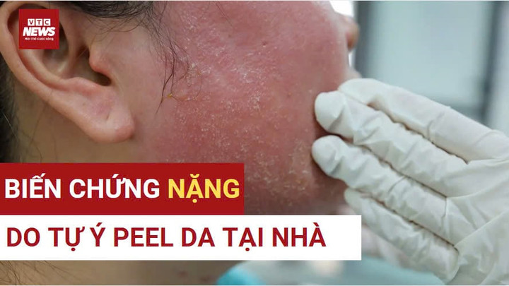 Trào lưu làm đẹp tại nhà: Tiện lợi hay tự rước họa vào thân?