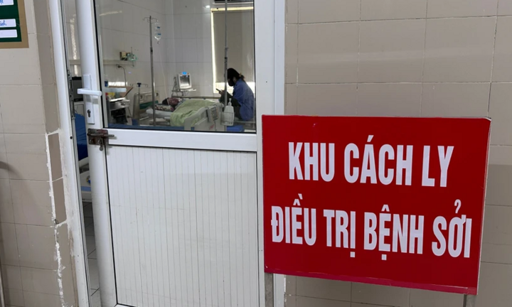 Ghi nhận ca tử vong đầu tiên do sởi ở người lớn trong năm 2025