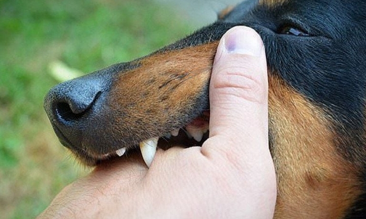 Uống thuốc nam sau khi bị chó cắn, bé trai 13 tuổi nguy kịch