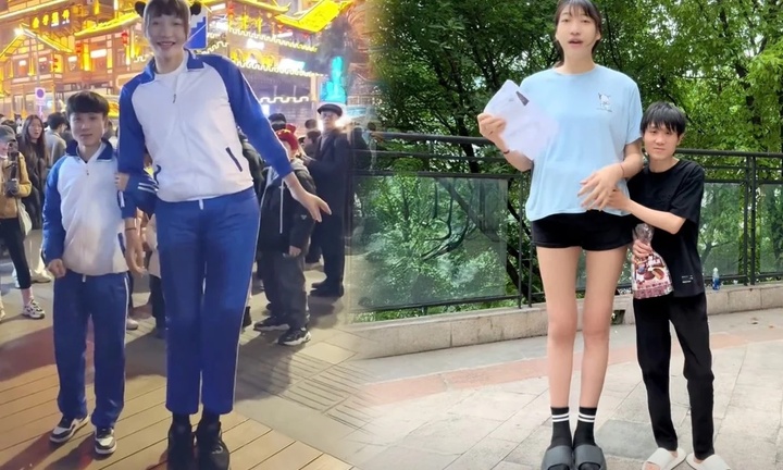 Bất chấp phản đối, cô gái 2,2m quyết sinh con cho 'chàng lùn' 1,68m