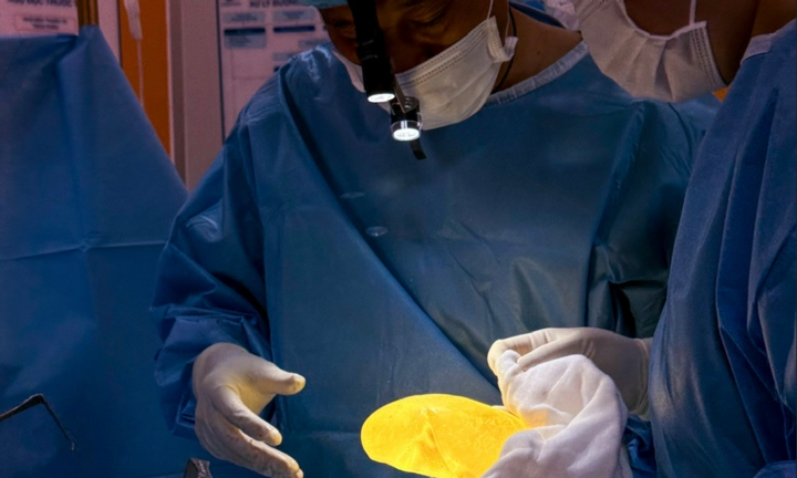 Lưu ý trước phẫu thuật thẩm mỹ dành cho người đang sử dụng thực phẩm chức năng