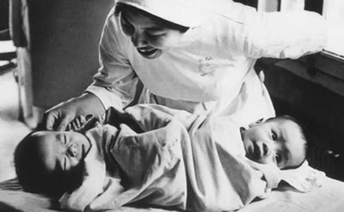 Ca mổ tách cặp song sinh Việt - Đức: Kỳ tích y học Việt Nam 37 năm trước