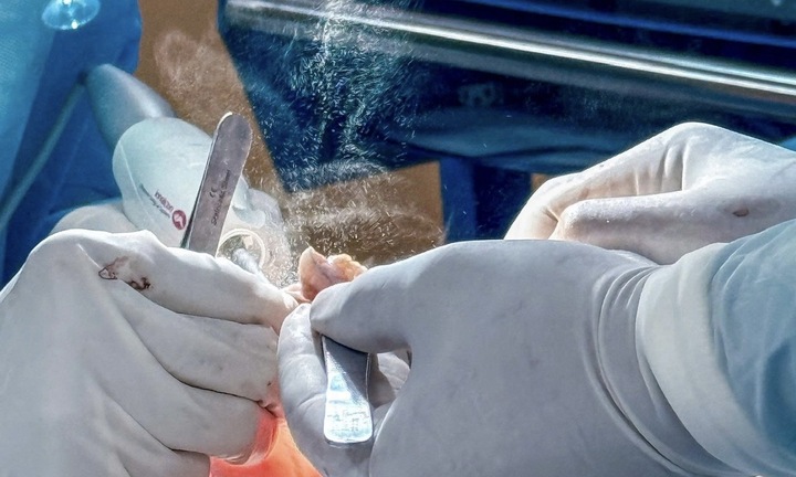 Ngực tái sa trễ: Nguyên nhân, dấu hiệu, phương pháp thẩm mỹ phù hợp