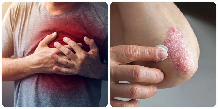 8 dấu hiệu cảnh báo thận không khoẻ