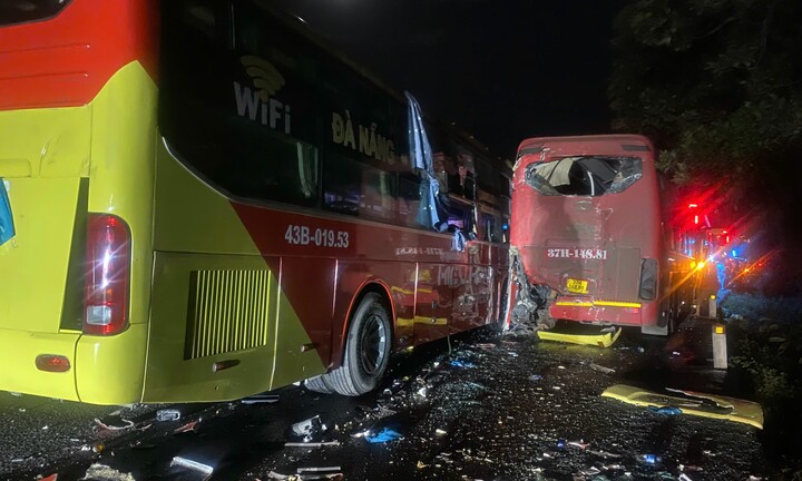 3 xe khách tông nhau liên hoàn ở Huế: Sức khỏe các nạn nhân bị thương ra sao?