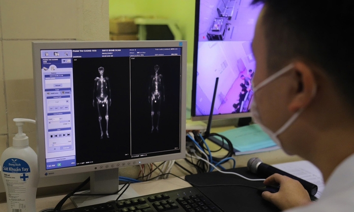 Máy xạ trị chạy 23 tiếng mỗi ngày vì quá tải bệnh nhân ung thư 