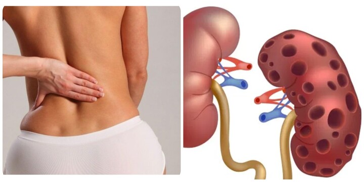 9 dấu hiệu thận yếu ở phụ nữ