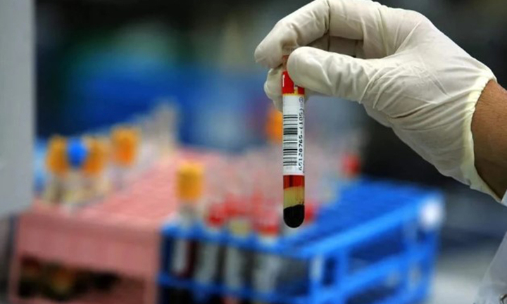 Phát hiện nhóm máu cực hiếm, cả thế giới chỉ một người mang