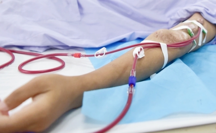 Suy thận ở tuổi 32 sau nhiều năm lạm dụng sản phẩm tăng cơ