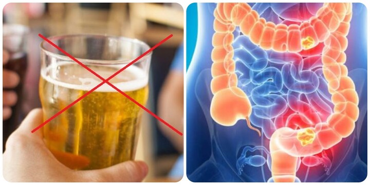 Bác sĩ chỉ cách phòng ngừa ung thư đại trực tràng