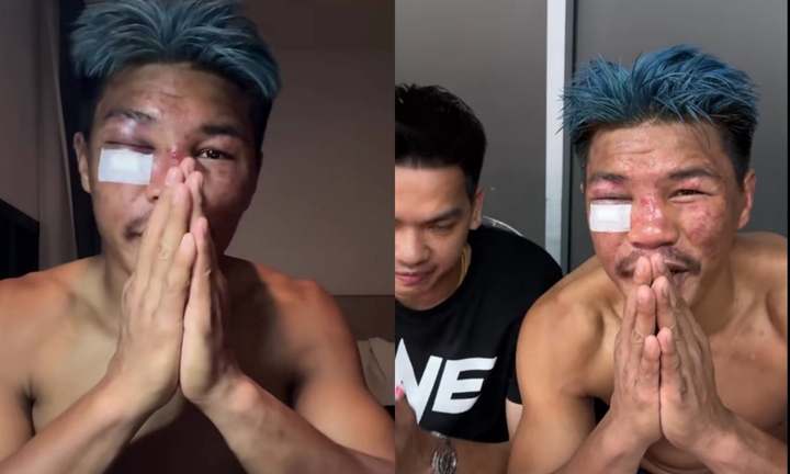 Bị võ sĩ châu Âu đánh sưng mặt, cao thủ Thái Lan chắp tay xin lỗi