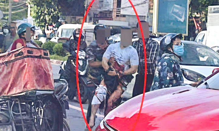 Điều tra vụ một Tiktoker nổi tiếng ở Thái Nguyên bị chém đứt bàn tay giữa đường