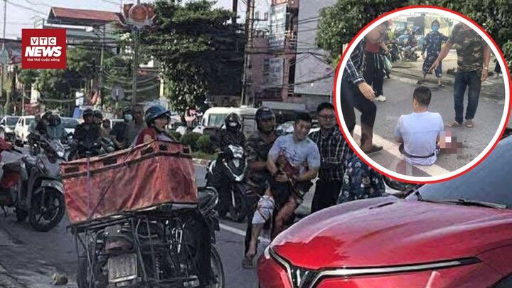 Tiktoker nổi tiếng ở Thái Nguyên bị chém đứt bàn tay trên đường