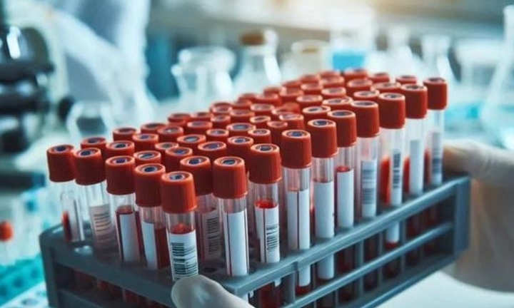 Hà Nội ghi nhận ca viêm não Nhật Bản đầu tiên trong năm, là trẻ 4 tháng tuổi