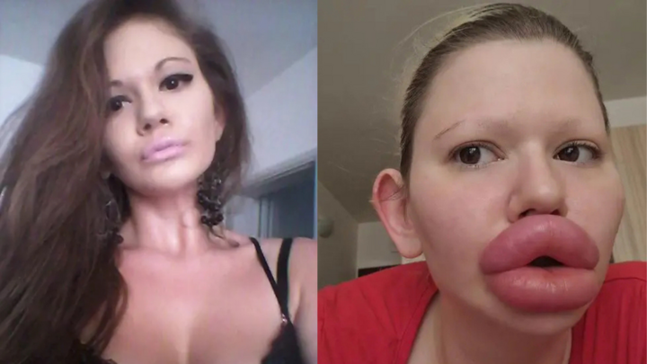 Nhan sắc mê hồn của cô gái có cặp môi lớn nhất thế giới trước khi 'dao kéo'