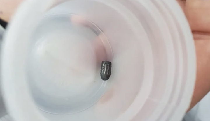 Người phụ nữ bất ngờ trúng đạn khi đang làm vườn