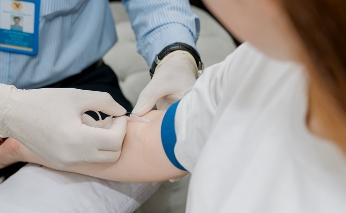 Mắc bệnh gout ở tuổi đôi mươi