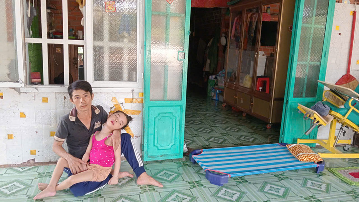 Cậu phụ hồ nhọc nhằn nuôi cháu teo não bị cha mẹ bỏ rơi