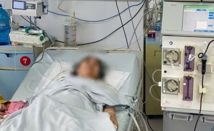 Ngừng tim, suy đa tạng vì nhiễm trùng từ vết ong đốt