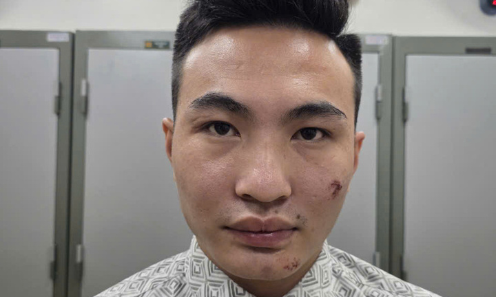 Tạm giữ thanh niên có nồng độ cồn, lao xe máy vào công an tại chốt bảo vệ A80