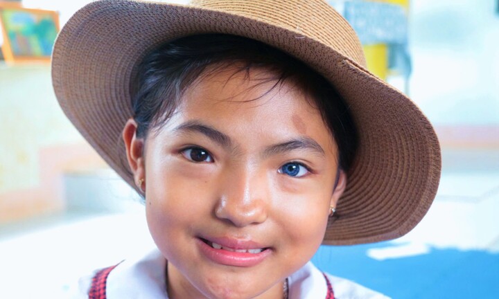 Kỳ lạ bé gái ở Đắk Lắk có hai màu mắt, một bên mắt đen và một bên mắt xanh