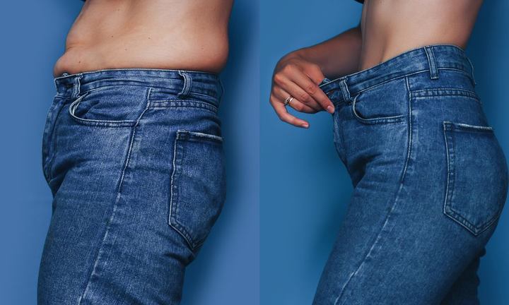 Phẫu thuật ‘nắn’ xương sườn giúp cô gái gen Z có vòng eo con kiến, giảm 15cm