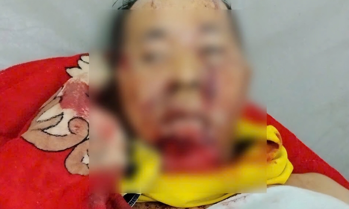 Trưởng thôn ở Đà Nẵng bị gấu rừng tấn công