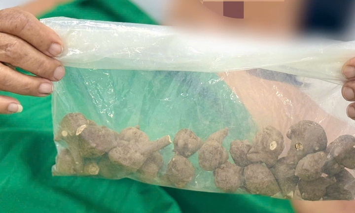 Sắc 5 củ ấu tẩu uống chữa đau khớp, cụ bà sốc tim suýt tử vong