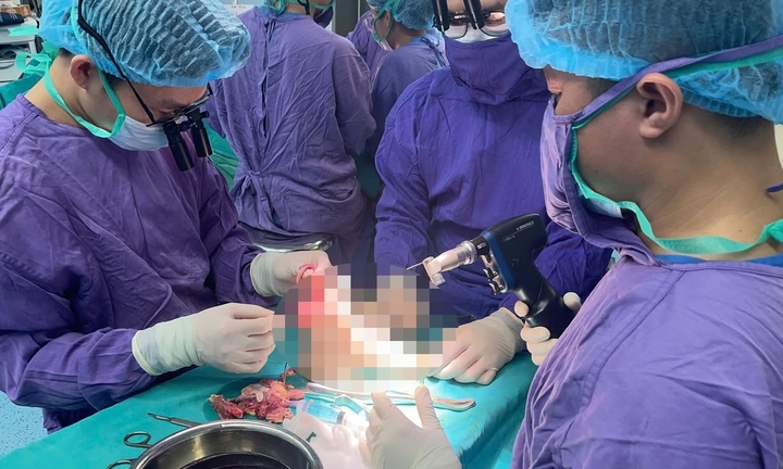 Nối lại chân đứt lìa cho nữ sinh 19 tuổi sau va chạm với mô tô phân khối lớn