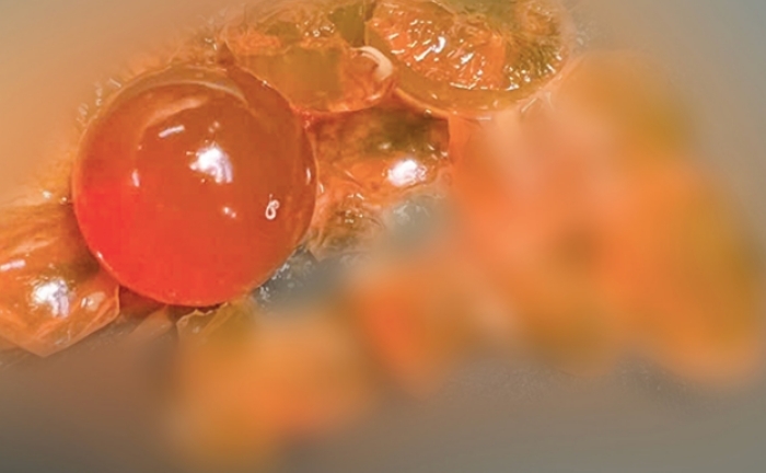 Bé trai 14 tháng tuổi phải nhập viện vì nuốt hạt nở đồ chơi