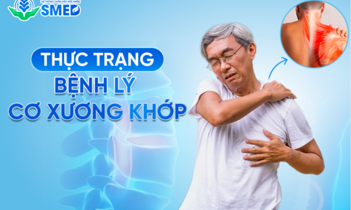 SMED – Hệ thống chăm sóc sức khỏe tiên phong trong điều trị cơ xương khớp