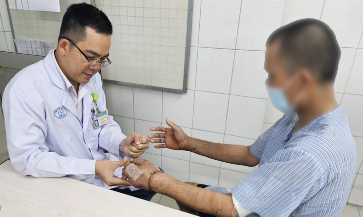 3 kíp bác sỹ phẫu thuật suốt 12 tiếng, cứu người bị chém đứt lìa 2 bàn tay