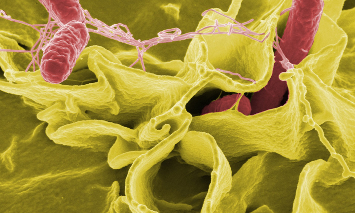 Vi khuẩn Salmonella gây ngộ độc thực phẩm nguy hiểm thế nào?