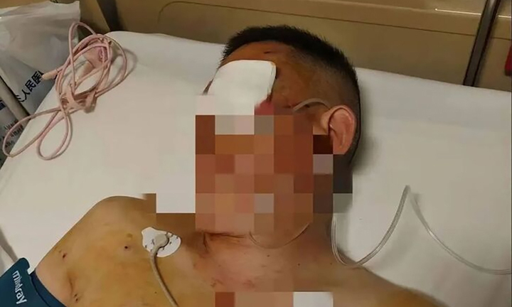 Khách rút tiền vật lộn với tên cướp 20 phút trước ngân hàng, bảo vệ bị tố mặc kệ