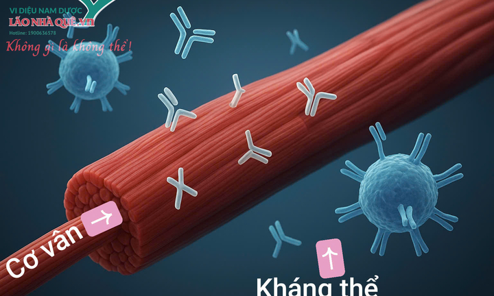 Kháng thể tự miễn tiêu cơ vân hướng phục hồi từ trị liệu khai thông cột sống