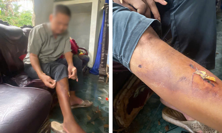 Xác định nhóm học sinh hành hung người đàn ông say rượu trong đêm ở Huế