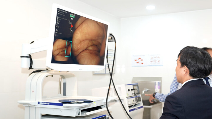 Hệ thống nội soi tiêu hóa ứng dụng AI tại Bệnh viện Đa khoa Tâm Trí Sài Gòn 