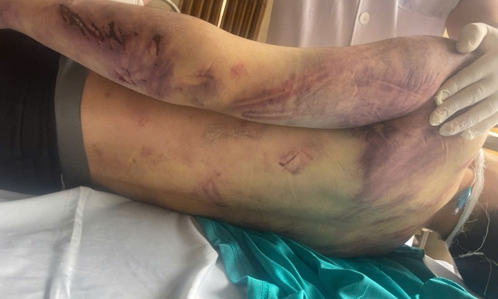 Bộ Y tế yêu cầu rà soát các cơ sở trợ giúp xã hội sau vụ học viên tử vong ở Quảng Ninh