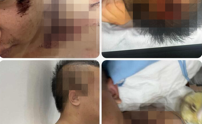 Ám ảnh trận đòn 'nhập môn' tại Trung tâm Công tác xã hội Hải Hà