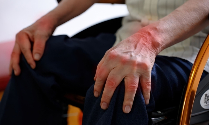 Thoát cảnh xe lăn sau nửa năm nhờ điều trị thành công viêm khớp dạng thấp nặng